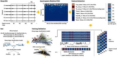 Age-integrated artificial intelligence framework for sleep stage classification and obstructive sleep apnea screening